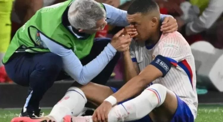 Mbappé, delantero del Real Madrid sufre fractura de nariz