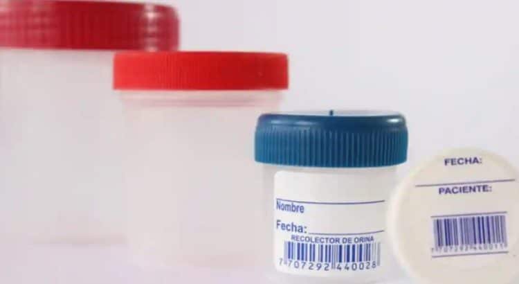 Gánate una lanita extra… vendiendo tus heces